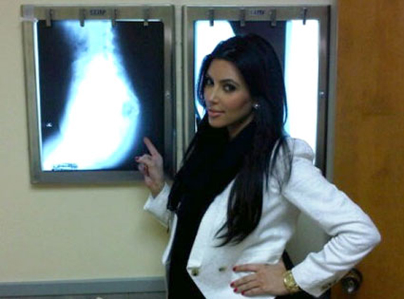 Kim Kardashian Butt X-Ray